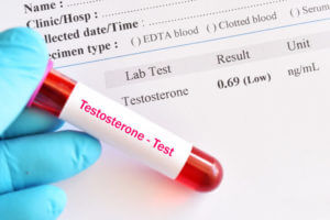 Abnormal low testosterone hormone test