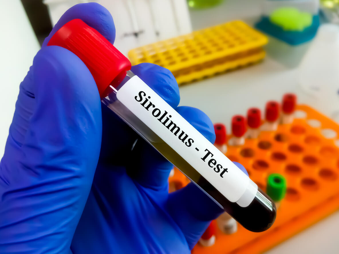 Blood sample for Sirolimus test - Rapamycin