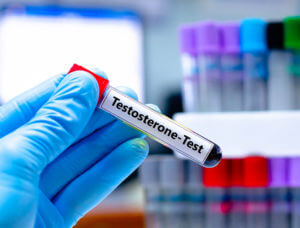 A medical test tube labeled with the word testosterone.