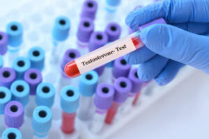 A doctor holding a blood sample tube for a testosterone test, with medical test tubes in the background.