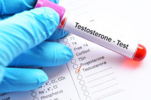 A healthcare provider in gloves holds a test tube labeled Testosterone Hormone Test to determine the need for Bioidentical Testosterone.