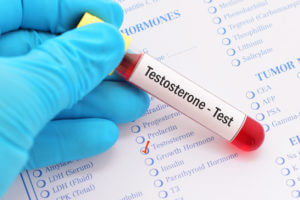 An image of a medical practitioner's hand in gloves holding a test tube used for a testosterone test to check for low testosterone levels.