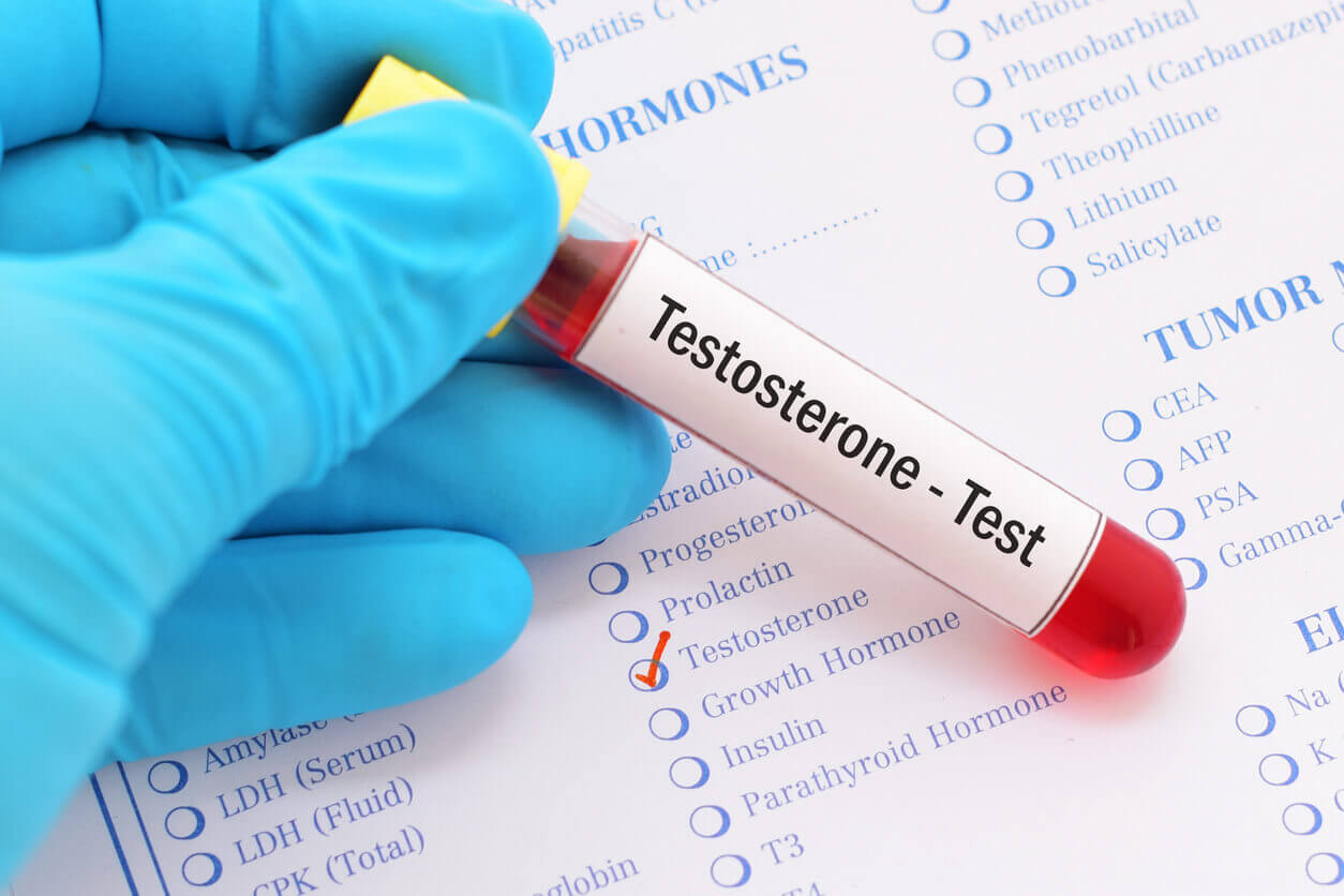 An image of a medical practitioner's hand in gloves holding a test tube used for a testosterone test to check for low testosterone levels.
