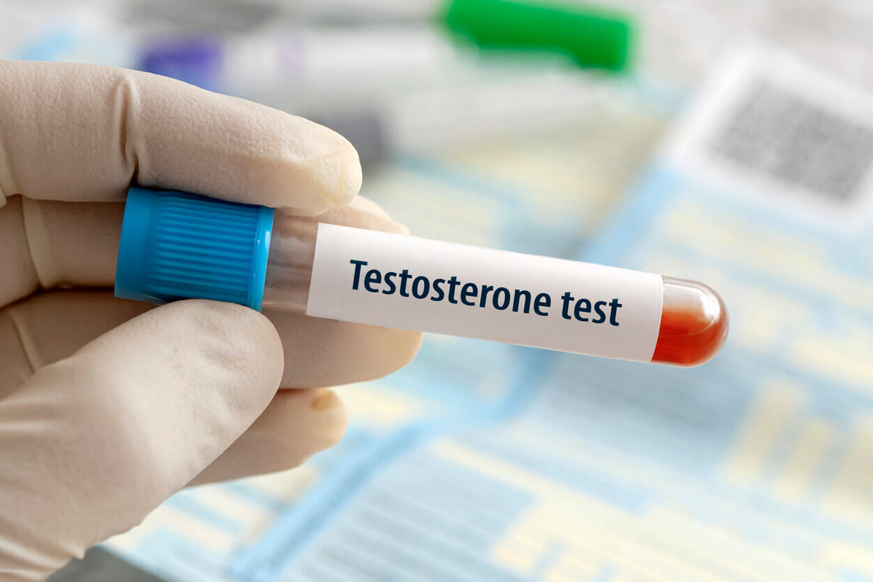 Testosterone hormone test result with blood sample in test tube on doctor hand in medical lab
